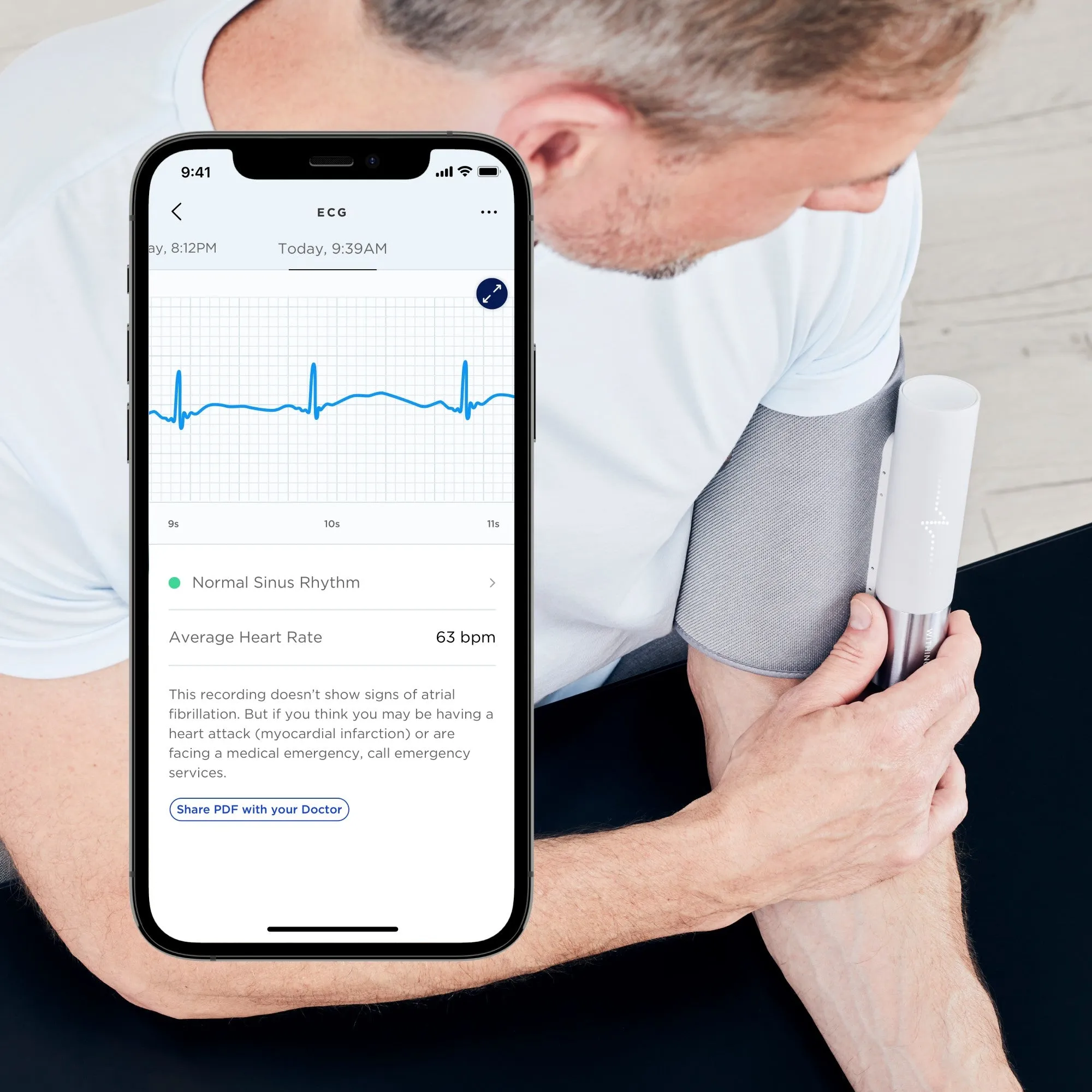 Withings Bpm Core Smart Blood Pressure Monitor